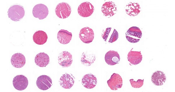 BN243-L37 Multiple normal (12 types) organ tissue array, 12 cases/24 ...