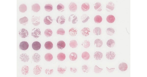 BN483c Multiple organ (24 types) normal tissue array, 24 cases/ 48 ...
