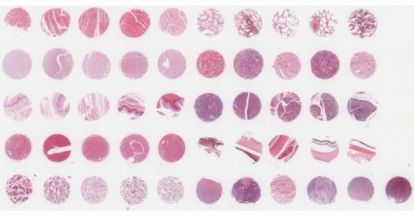 BN501a Multiple organ normal tissue array, 50 cases/50 cores, replacing ...