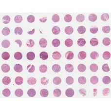 BS02041