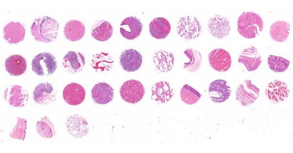 FDA331b Multi-organ normal tissue array, representing FDA guideline for ...