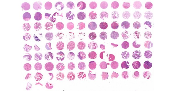 FDA999-L831 Multi- organ normal tissue array, representing FDA ...