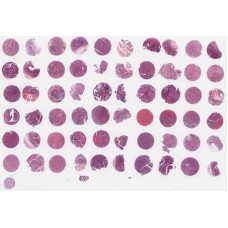 HStm-Ade060PG-01