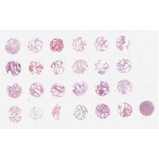 LCN241