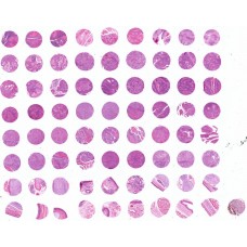 LP721