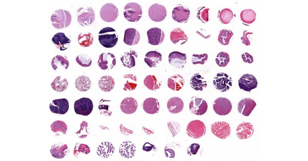 MOJ621a Mouse (C57BL/6J strain) multiple normal organ tissue array, 6 ...