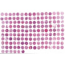 NSC156