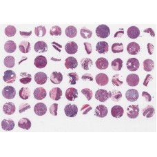 OD-CT-DgCol03-003