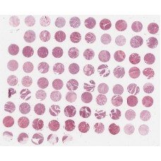 OD-CT-DgCol04-003