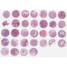 OD-CT-RsLug02-004