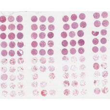 OD-CT-RsLug04-003