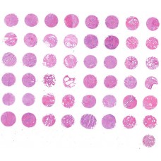 PR481a