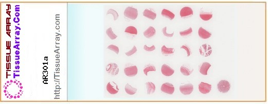 TissueArray.Com Tissue Array AR301a