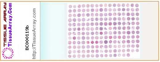 TissueArray.Com Tissue Array BC000119b