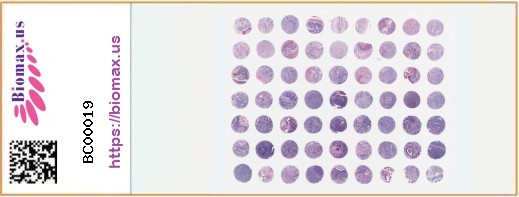 TissueArray.Com Tissue Array BC00019