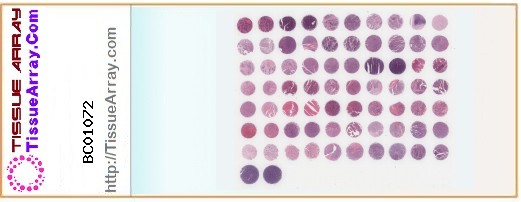 TissueArray.Com Tissue Array BC01072