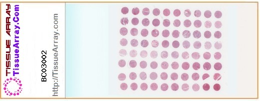 TissueArray.Com Tissue Array BC03002