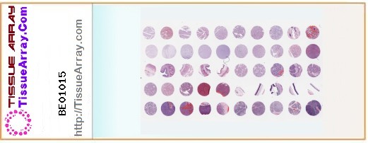 TissueArray.Com Tissue Array BE01015