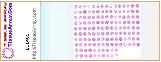 TissueArray.Com Tissue Array BL1401
