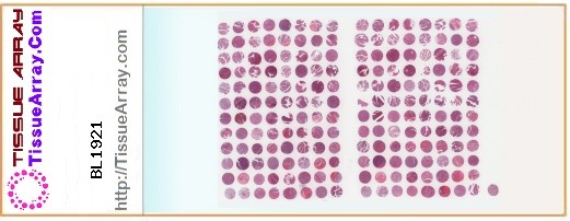TissueArray.Com Tissue Array BL1921
