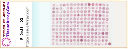 TissueArray.Com Tissue Array BL2081-L23