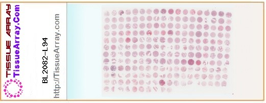 TissueArray.Com Tissue Array BL2082-L94