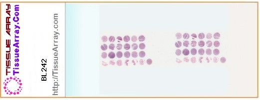 TissueArray.Com Tissue Array BL242