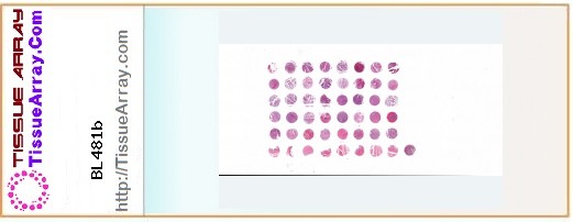 TissueArray.Com Tissue Array BL481b