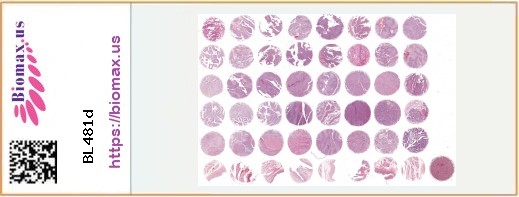 TissueArray.Com Tissue Array BL481d
