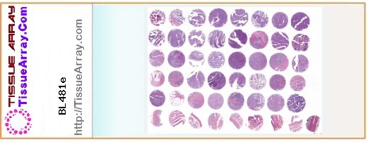 TissueArray.Com Tissue Array BL481e