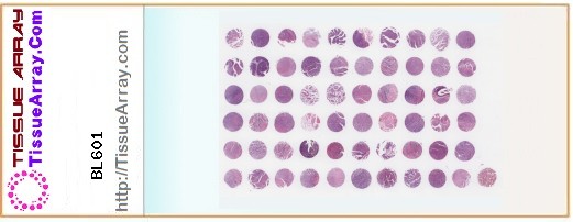 TissueArray.Com Tissue Array BL601