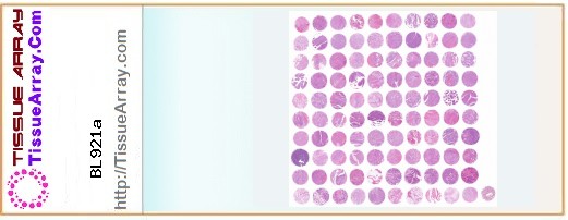 TissueArray.Com Tissue Array BL921a