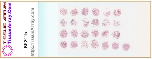 TissueArray.Com Tissue Array BM241b