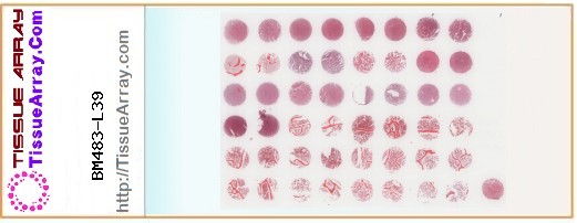TissueArray.Com Tissue Array BM483-L39