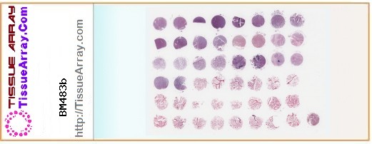 TissueArray.Com Tissue Array BM483b