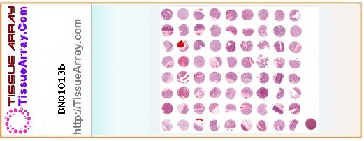 TissueArray.Com Tissue Array BN01013b
