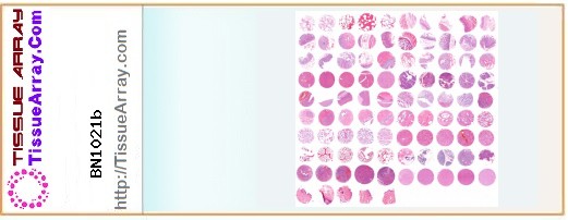 TissueArray.Com Tissue Array BN1021b