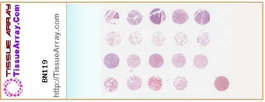 TissueArray.Com Tissue Array BN119