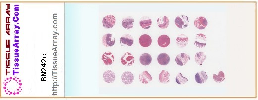 TissueArray.Com Tissue Array BN242c