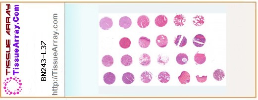 TissueArray.Com Tissue Array BN243-L37