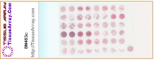 TissueArray.Com Tissue Array BN483c
