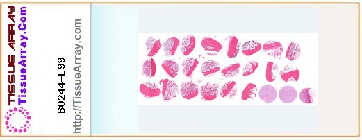 TissueArray.Com Tissue Array BO244-L99