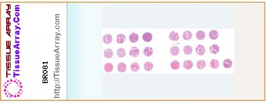 TissueArray.Com Tissue Array BR081
