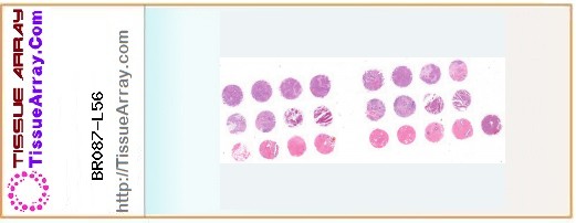TissueArray.Com Tissue Array BR087-L56