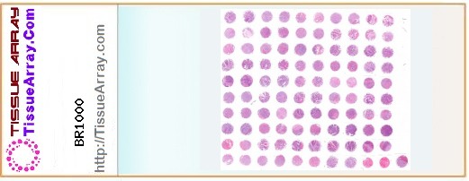 TissueArray.Com Tissue Array BR1000