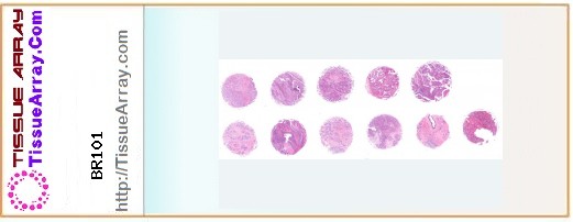 TissueArray.Com Tissue Array BR101