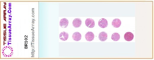 TissueArray.Com Tissue Array BR102