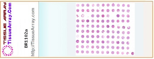 TissueArray.Com Tissue Array BR1102a