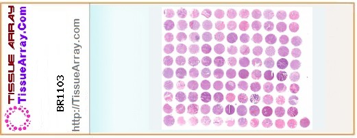 TissueArray.Com Tissue Array BR1103