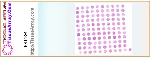 TissueArray.Com Tissue Array BR1104